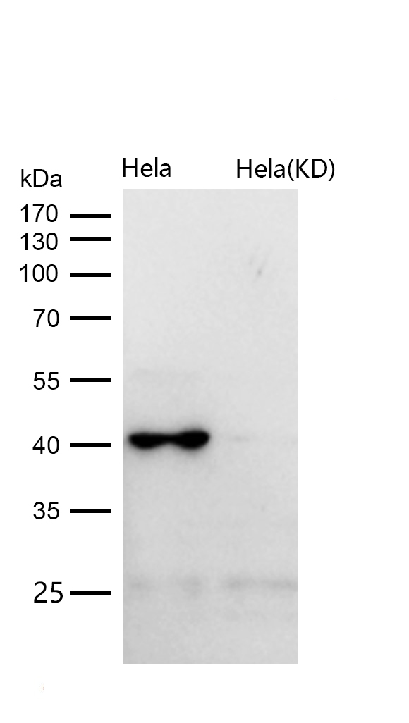 Spermine synthase Rabbit mAb