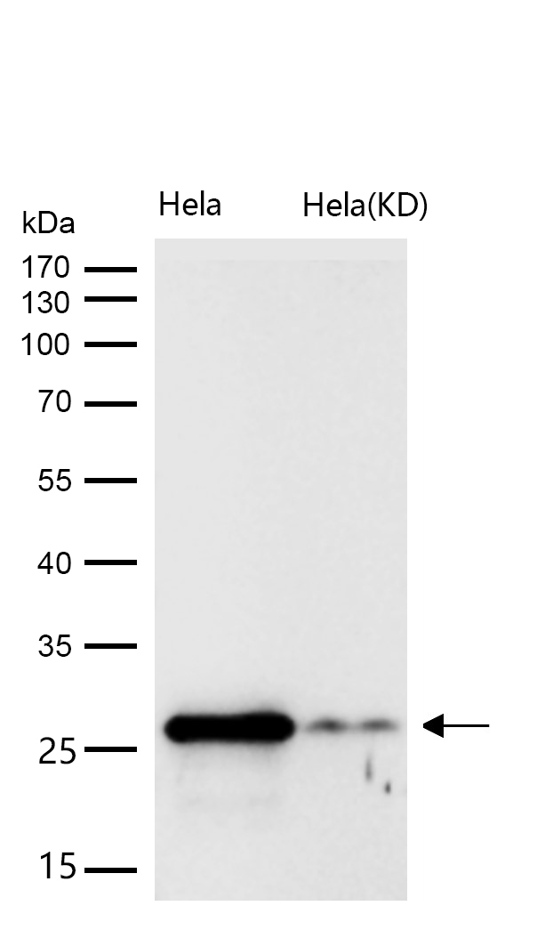 Galectin 3 Rabbit mAb