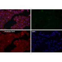 MSH6 Antibody