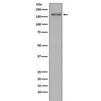 MSH6 Antibody