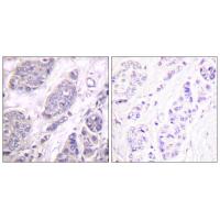 TGFβ3 Polyclonal Antibody