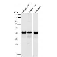 TDP 43 Rabbit mAb