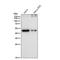 TDP 43 Rabbit mAb