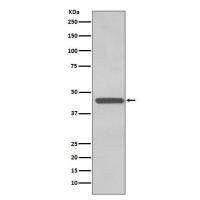 TDP 43 Rabbit mAb