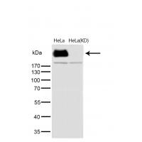 DNA PKcs (Phospho-Ser2056) Rabbit mAb