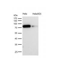 Glycogen synthase 1 (Phospho-Ser641) Rabbit mAb