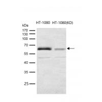 Src (Phospho-Tyr419) Rabbit mAb