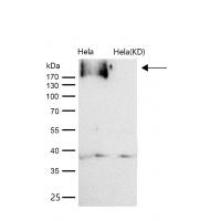 EGFR (Phospho-Y1197) Rabbit mAb