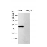 CDC37 (Phospho-Ser13) Rabbit mAb