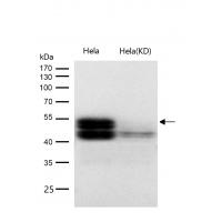 RUNX1/RUNX2/RUNX3 Rabbit mAb 