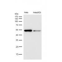 Caspase-2 Rabbit mAb