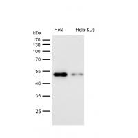 Cyclin A1/A2 Rabbit mAb