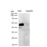 TGF beta 1 Rabbit mAb