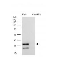 Cathepsin L/V/K/H Rabbit mAb