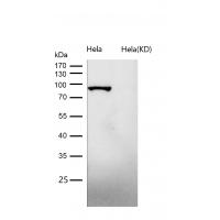 Dynamin 1 Rabbit mAb