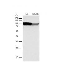 EEF2 Rabbit mAb 