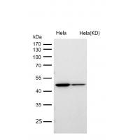 Aspartate Aminotransferase Rabbit mAb 