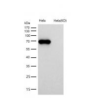 Alkaline phosphatase Rabbit mAb