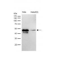 ABHD5 Rabbit mAb