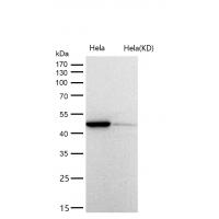 eIF4A1 Rabbit mAb