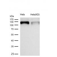 Eph receptor B1 Rabbit mAb