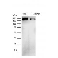 Aminopeptidase A / CD249 Rabbit mAb