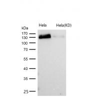 GOLPH4 Rabbit mAb