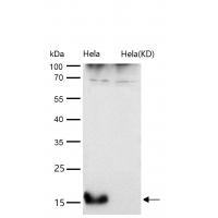 AP2S1 Rabbit mAb