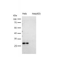 Calpain small subunit 1 Rabbit mAb