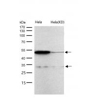 CD97 Rabbit mAb