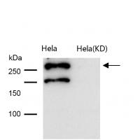 Desmoplakin Rabbit mAb