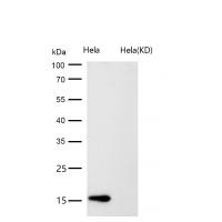 CDKN2C Rabbit mAb