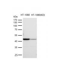 DGAT1 Rabbit mAb