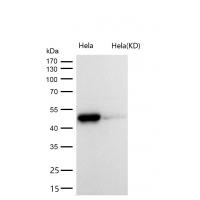 Galactosidase alpha Rabbit mAb