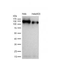 BCAR1 Rabbit mAb