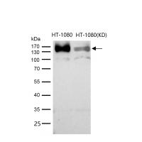 ATP7b Rabbit mAb