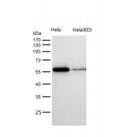 DLDH Rabbit mAb