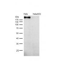 RhoGAP Rabbit mAb