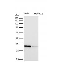 Gemin 2 Rabbit mAb