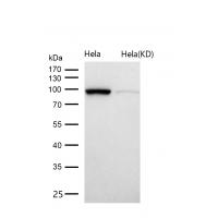 AP1G1 Rabbit mAb