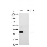 ACAT2 Rabbit mAb