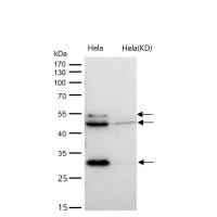 Bag1 Rabbit mAb