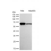 HRPT2 / CDC73 Rabbit mAb