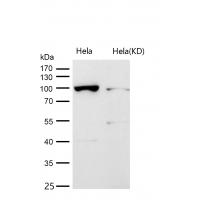 Desmocollin 1 Rabbit mAb