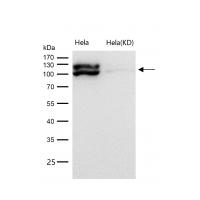 MKLP1 Rabbit mAb