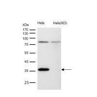 Rad51 Rabbit mAb