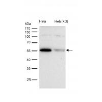 HDAC1 Rabbit mAb