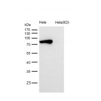 STAT1 Rabbit mAb