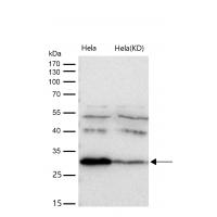 BDNF Rabbit mAb  