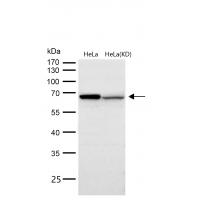 MMP14 Rabbit mAb 